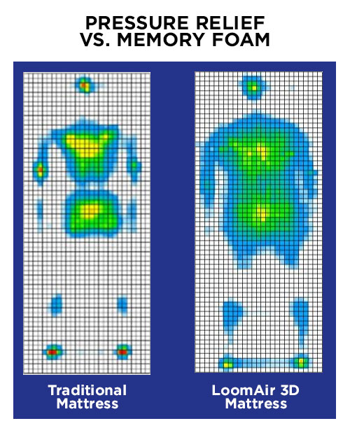 Chiromatic's LoomAir 3D Technology reduced point pressure 35% vs. memory foam